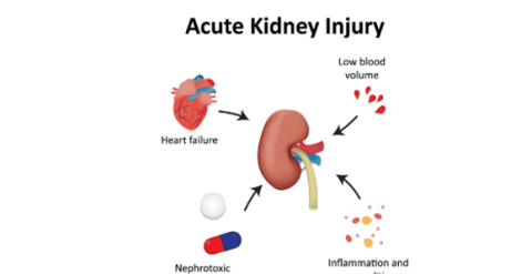 University of Minnea: D flavonoids prevent gentamicin-induced kidney damage