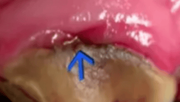  Cat oral disease - periodontitis